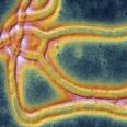 how-to-survive-the-ebola-virus